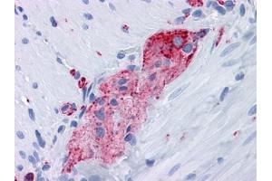 Immunohistochemical analysis of paraffin-embedded human Small Intestine, myenteric plexus tissues using anti-SYP antibody (Synaptophysin anticorps)