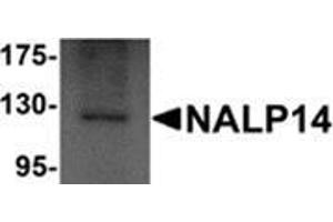 Western blot analysis of NALP14 in rat brain tissue lysate with NALP14 antibody at 1 μg/ml. (NLRP14 anticorps  (N-Term))