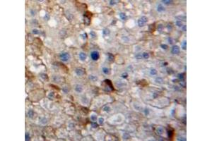Used in DAB staining on fromalin fixed paraffin-embedded Liver tissue (GAP43 anticorps  (AA 8-228))