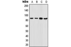 Western blot analysis of FOXM1 expression in SW480 (A), 22RV1 (B), NIH3T3 (C), rat colon (D) whole cell lysates. (FOXM1 anticorps  (Center))