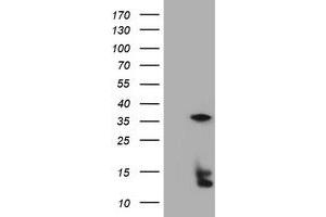 Image no. 5 for anti-Thymidylate Synthetase (TYMS) antibody (ABIN1501591) (TYMS anticorps)