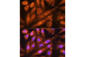 Immunofluorescence analysis of H9C2 cells using PSMD4 Rabbit pAb (ABIN3021329, ABIN3021330, ABIN3021331 and ABIN6214913) at dilution of 1:100.