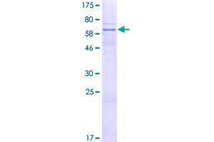 Image no. 1 for CPX Chromosome Region, Candidate 1 (CPXCR1) (AA 1-301) protein (GST tag) (ABIN1350257)