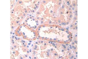 Used in DAB staining on fromalin fixed paraffin- embedded kidney tissue (LIFR anticorps  (AA 692-833))