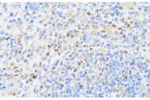 Immunohistochemistry of paraffin-embedded Rat spleen using UQCC2 Polyclonal Antibody at dilution of 1:100 (40x lens). (MNF1 anticorps)