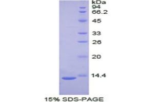 SDS-PAGE (SDS) image for Plasminogen Activator, Tissue (PLAT) (AA 36-126) protein (His tag) (ABIN1878307)