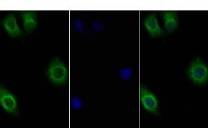 Detection of IL10Rb in Human Hela cell using Polyclonal Antibody to Interleukin 10 Receptor Beta (IL10Rb)