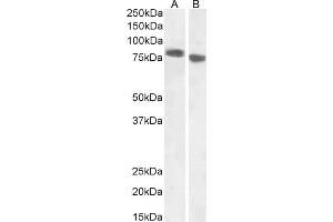 (ABIN238631) (1 μg/mL) staining of A431 (A) and (0. (EPB41L5 anticorps  (Internal Region))