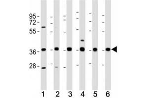 Western blot testing of MICA antibody at 1:2000 dilution. (MICA anticorps  (AA 68-97))
