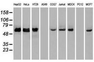 Image no. 5 for anti-Checkpoint Kinase 2 (CHEK2) antibody (ABIN1497495)