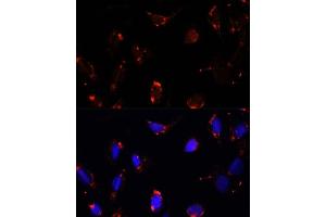 Immunofluorescence analysis of U-2 OS cells using TBRG4 antibody  at dilution of 1:100. (TBRG4 anticorps  (AA 382-631))