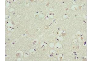 Immunohistochemistry of paraffin-embedded human brain tissue using ABIN7157744 at dilution of 1:100 (KCNIP2 anticorps  (AA 1-90))