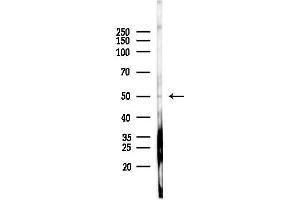 Western blot analysis of lysates from Rat brain, using LRP11 Antibody at 1/1000 dilution.