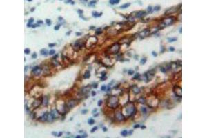 IHC-P analysis of Stomach tissue, with DAB staining. (CD79a anticorps  (AA 36-219))