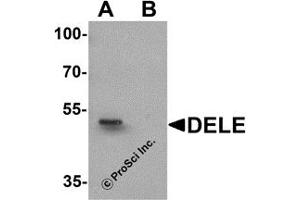 Western Blotting (WB) image for anti-DAP3 Binding Cell Death Enhancer 1 (DELE1) (N-Term) antibody (ABIN1031350) (DELE1/KIAA0141 anticorps  (N-Term))
