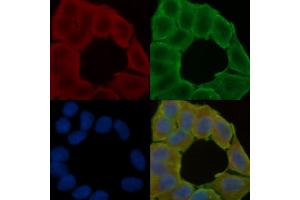 ABIN6258566 and ABIN6275701 staining Hela cells(24h of starvation treatment) by IF/ICC.
