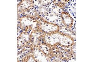 Immunohistochemistry of paraffin embedded rat kidney using SLC7A8 (ABIN7074503) at dilution of 1:1100 (400x lens)