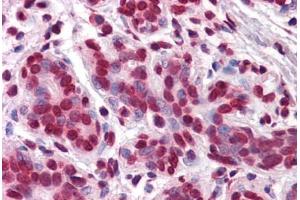 Human Breast: Formalin-Fixed, Paraffin-Embedded (FFPE)