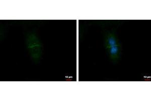 ICC/IF Image CD99L2 antibody detects CD99L2 protein at Cell membrane by immunofluorescent analysis. (CD99L2 anticorps)