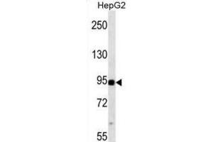 Western Blotting (WB) image for anti-Mitogen-Activated Protein Kinase Kinase Kinase 11 (MAP3K11) antibody (ABIN2938456)
