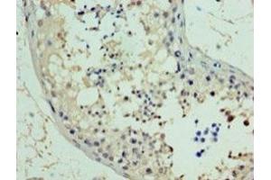 Immunohistochemistry of paraffin-embedded human testis tissue using PA889102LA01HU at dilution of 1:100