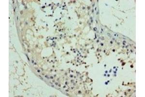 Immunohistochemistry of paraffin-embedded human testis tissue using PA889102LA01HU at dilution of 1:100 (RAD18 anticorps  (AA 1-495))