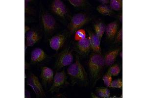 Immunofluorescence staining of methanol-fixed HeLa cells using Phospho-NFKB1-S337 antibody (ABIN2987371). (NFKB1 anticorps  (pSer337))