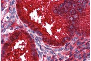 Human Uterus: Formalin-Fixed, Paraffin-Embedded (FFPE) (SERPING1 anticorps  (AA 1-501))