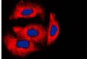 Immunofluorescent analysis of Cytochrome b5A staining in HeLa cells.
