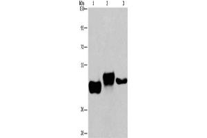 Gel: 6 % SDS-PAGE, Lysate: 40 μg, Lane 1-3: Human placenta tissue, Human fetal liver tissue, HepG2 cells, Primary antibody: ABIN7192345(SGK2 Antibody) at dilution 1/100, Secondary antibody: Goat anti rabbit IgG at 1/8000 dilution, Exposure time: 8 minutes (SGK2 anticorps)