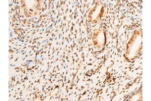 ABIN6267301 at 1/100 staining rat uterine tissue sections by IHC-P.
