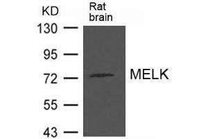 Western blot analysis of extract from Rat brain tissue using MELK Antibody (MELK anticorps)