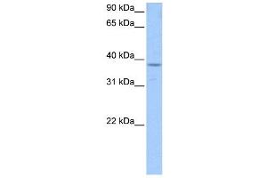 PCBP1 antibody used at 1 ug/ml to detect target protein. (PCBP1 anticorps)
