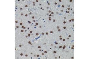 Immunohistochemistry of paraffin-embedded rat brain using SM antibody (ABIN1682808, ABIN5663732, ABIN5663734 and ABIN6213914) (40x lens).