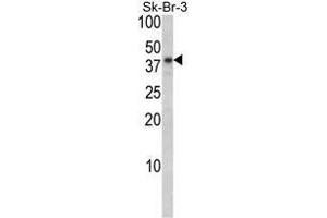 Image no. 1 for anti-Biglycan (BGN) (AA 155-184), (Middle Region) antibody (ABIN452781) (Biglycan anticorps  (Middle Region))