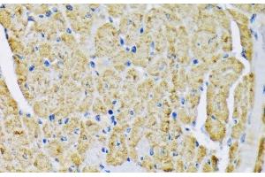 Immunohistochemistry of paraffin-embedded Mouse heart using HK2 Polyclonal Antibody at dilution of 1:200 (40x lens). (Hexokinase 2 anticorps)