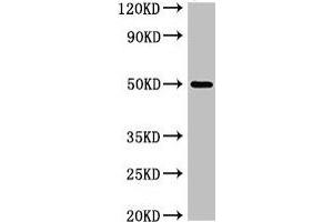 Western Blot Positive WB detected in: K562 whole cell lysate All lanes: SGMS1 antibody at 4 μg/mL Secondary Goat polyclonal to rabbit IgG at 1/50000 dilution Predicted band size: 49, 26 kDa Observed band size: 49 kDa (Sphingomyelin Synthase 1 anticorps  (AA 48-137))