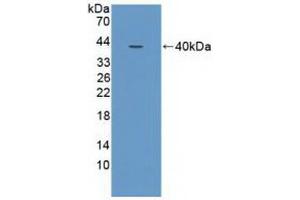 Western blot analysis of recombinant Human NCOA3. (NCOA3 anticorps  (AA 1023-1304))