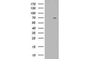 Western Blotting (WB) image for anti-Tripartite Motif Containing 2 (TRIM2) (AA 1-100), (AA 645-744) antibody (ABIN1490542) (TRIM2 anticorps  (AA 1-100, AA 645-744))