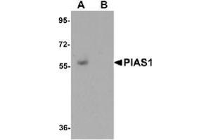 Western blot analysis of PIAS1 in human kidney tissue lysate with PIAS1 antibody at 1 μg/ml in (A) the absence and (B) the presence of blocking peptide.