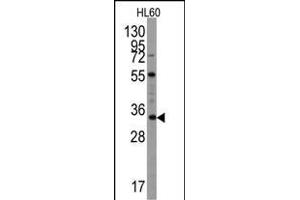 Western blot analysis of UBTD1 Antibody (C-term ) (ABIN387937 and ABIN2844471) in Hl60 cell line lysates (35 μg/lane). (UBTD1 anticorps  (C-Term))