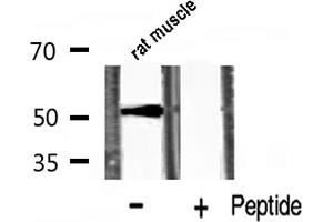 Western blot analysis of p53 phosphorylation expression in rat muscle lysates,The lane on the right is treated with the antigen-specific peptide. (p53 anticorps  (pSer20))