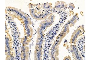 ABIN6259596 and ABIN6275561 at 1/100 staining rat colorectal tissue by IHC-P. (SH2D2A anticorps  (C-Term))