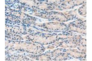 IHC-P analysis of Mouse Intestine Tissue, with DAB staining. (PTPRJ anticorps  (AA 567-842))
