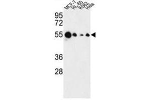 Western blot analysis of AIM2 Antibody (N-term) in MCF-7, HL-60, K562, Hela cell line lysates (35 µg/lane). (AIM2 anticorps  (N-Term))