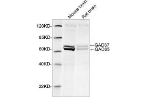 Western blot analysis of tissue lysates using 1 µg/mL Rabbit Anti-GAD65+GAD67 Polyclonal Antibody (ABIN398919) The signal was developed with IRDyeTM 800 Conjugated Goat Anti-Rabbit IgG. (GAD65+GAD67 (AA 550-600) anticorps)