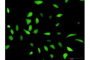 Immunofluorescence of purified MaxPab antibody to HDAC2 on HeLa cell. (HDAC2 anticorps  (AA 1-582))