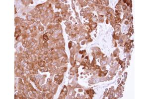 IHC-P Image Immunohistochemical analysis of paraffin-embedded OVCAR3 xenograft, using PPA1, antibody at 1:500 dilution.