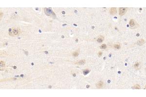 Detection of LEP in Human Cerebrum Tissue using Polyclonal Antibody to Leptin (LEP)