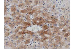 Immunohistochemical staining of paraffin-embedded Human liver tissue using anti-PTPRE mouse monoclonal antibody. (PTPRE anticorps)